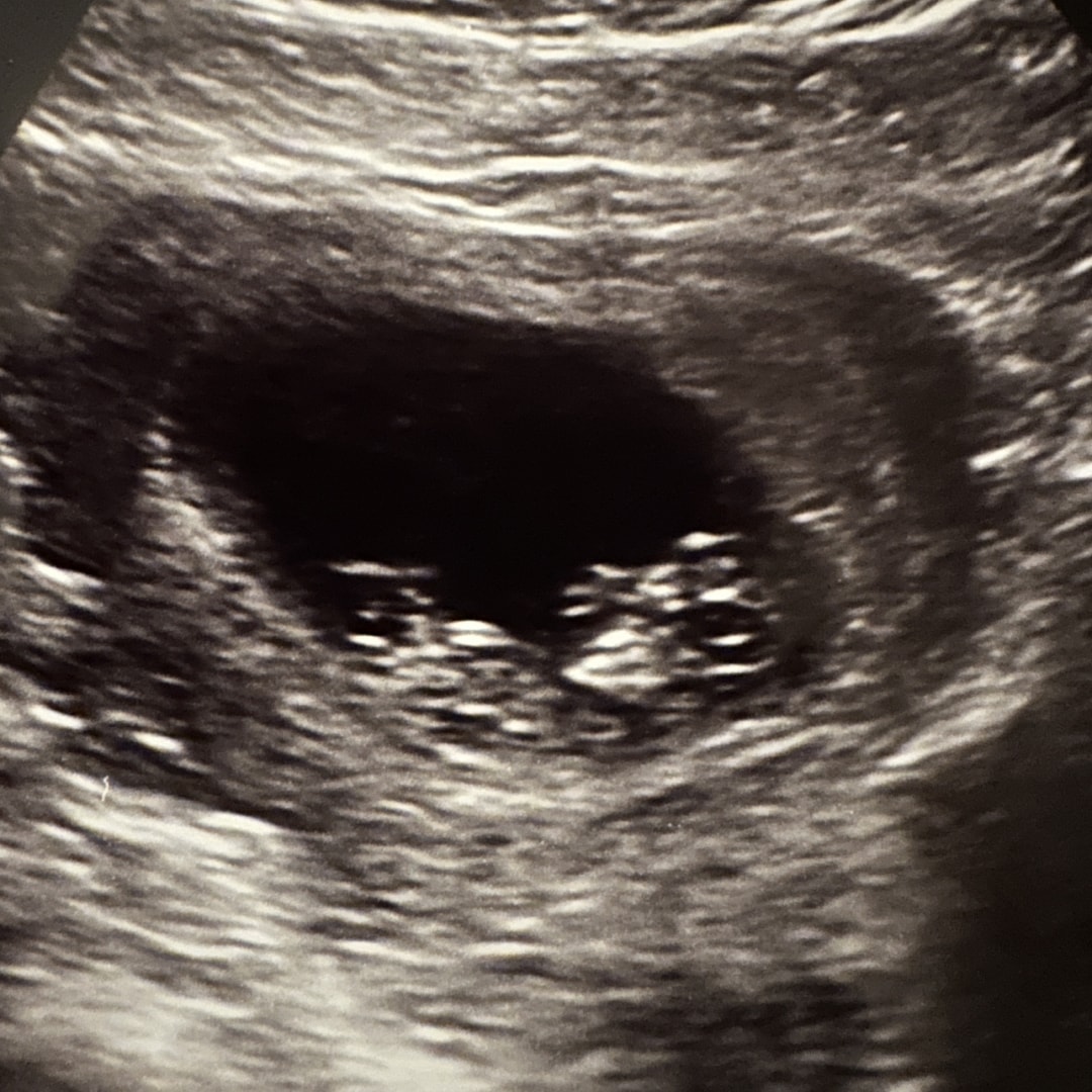 Photo shared by James for their Babylist baby registry.