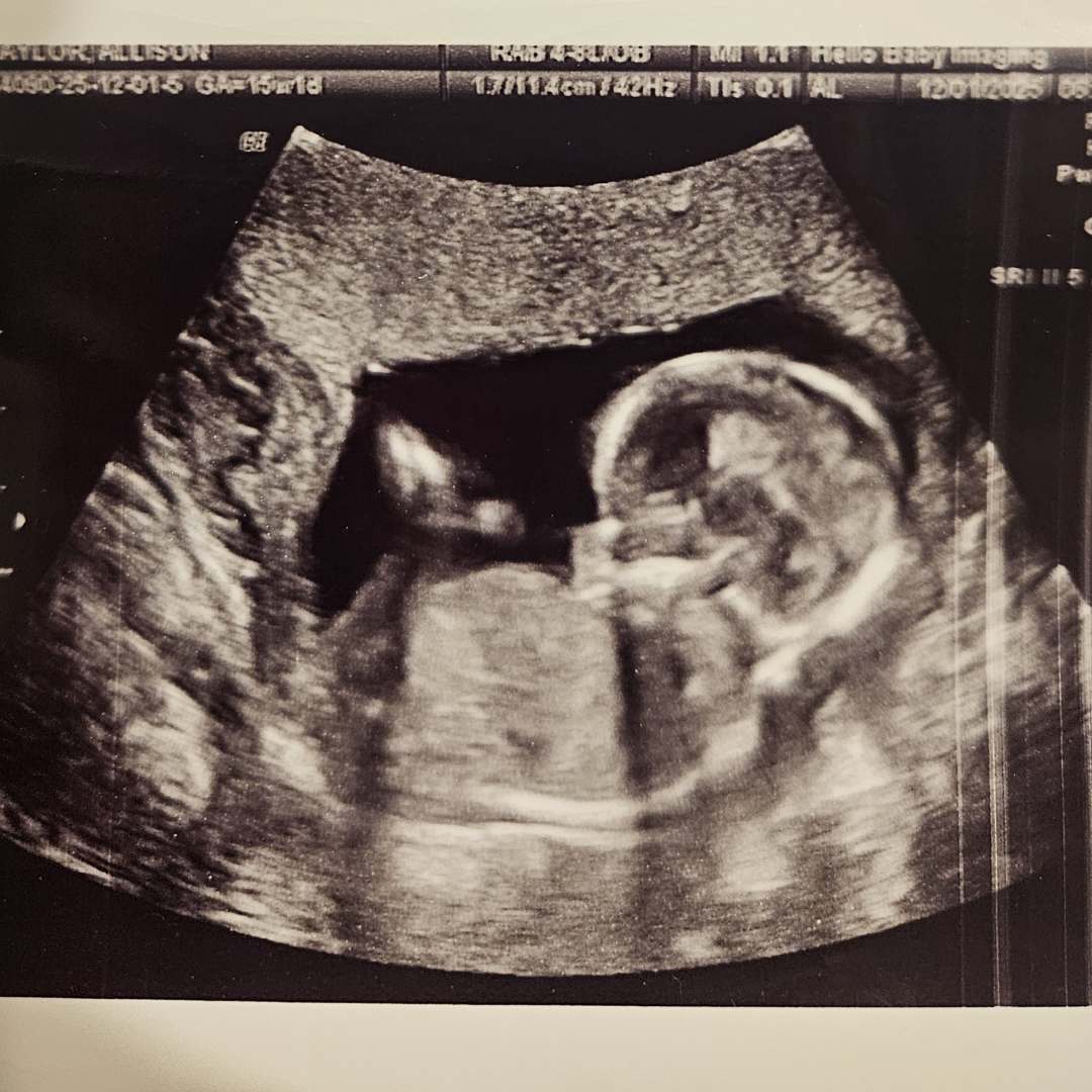 Photo shared by Allison for their Babylist baby registry.