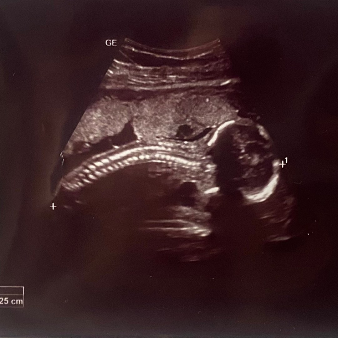 Photo shared by Jazmine for their Babylist baby registry.