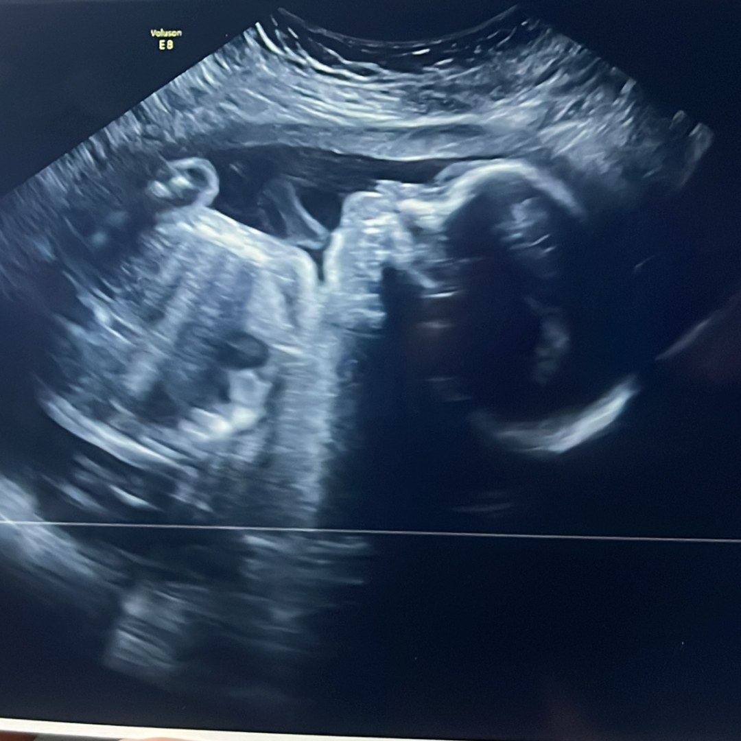 Photo shared by Noraliz for their Babylist baby registry.