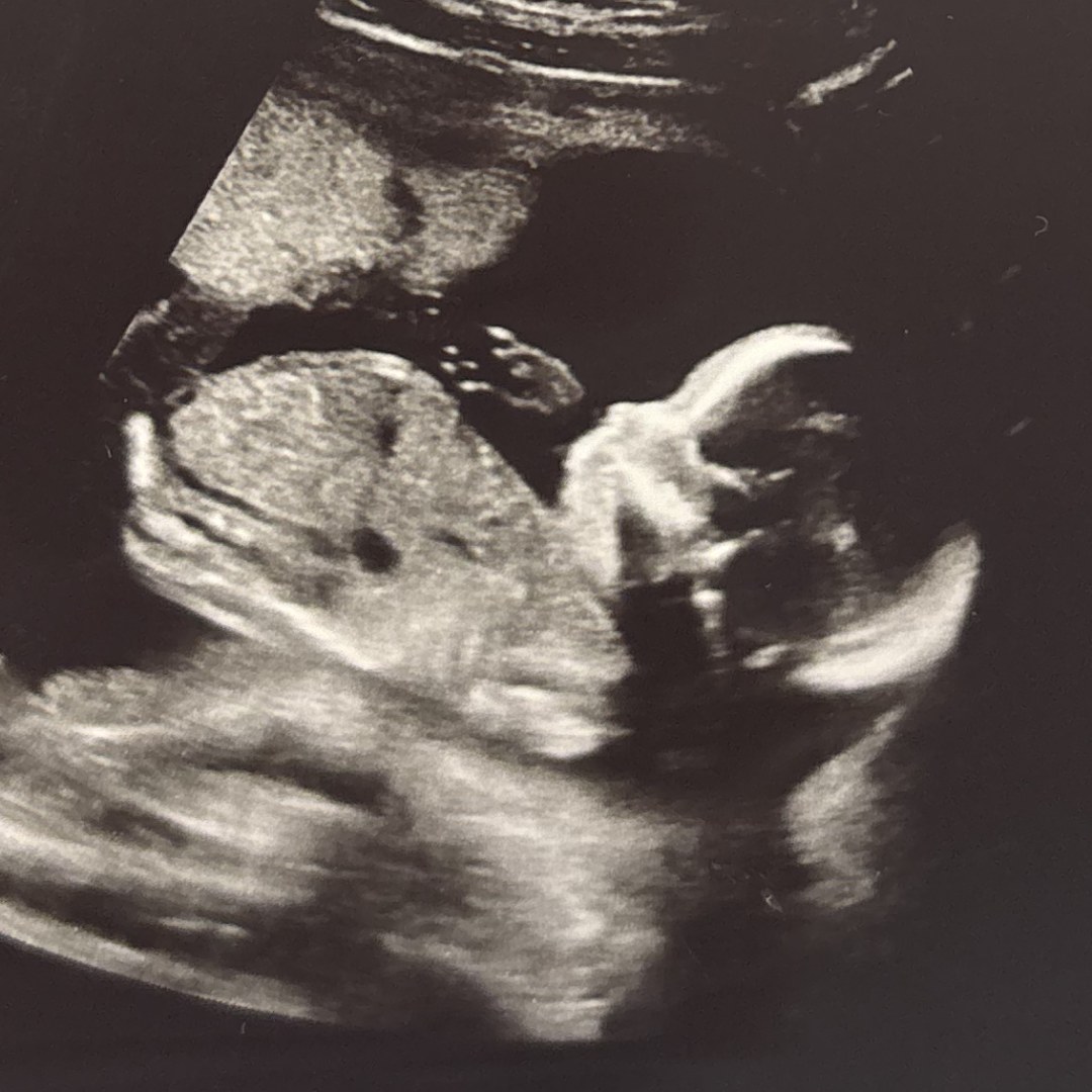 Photo shared by Abigail for their Babylist baby registry.