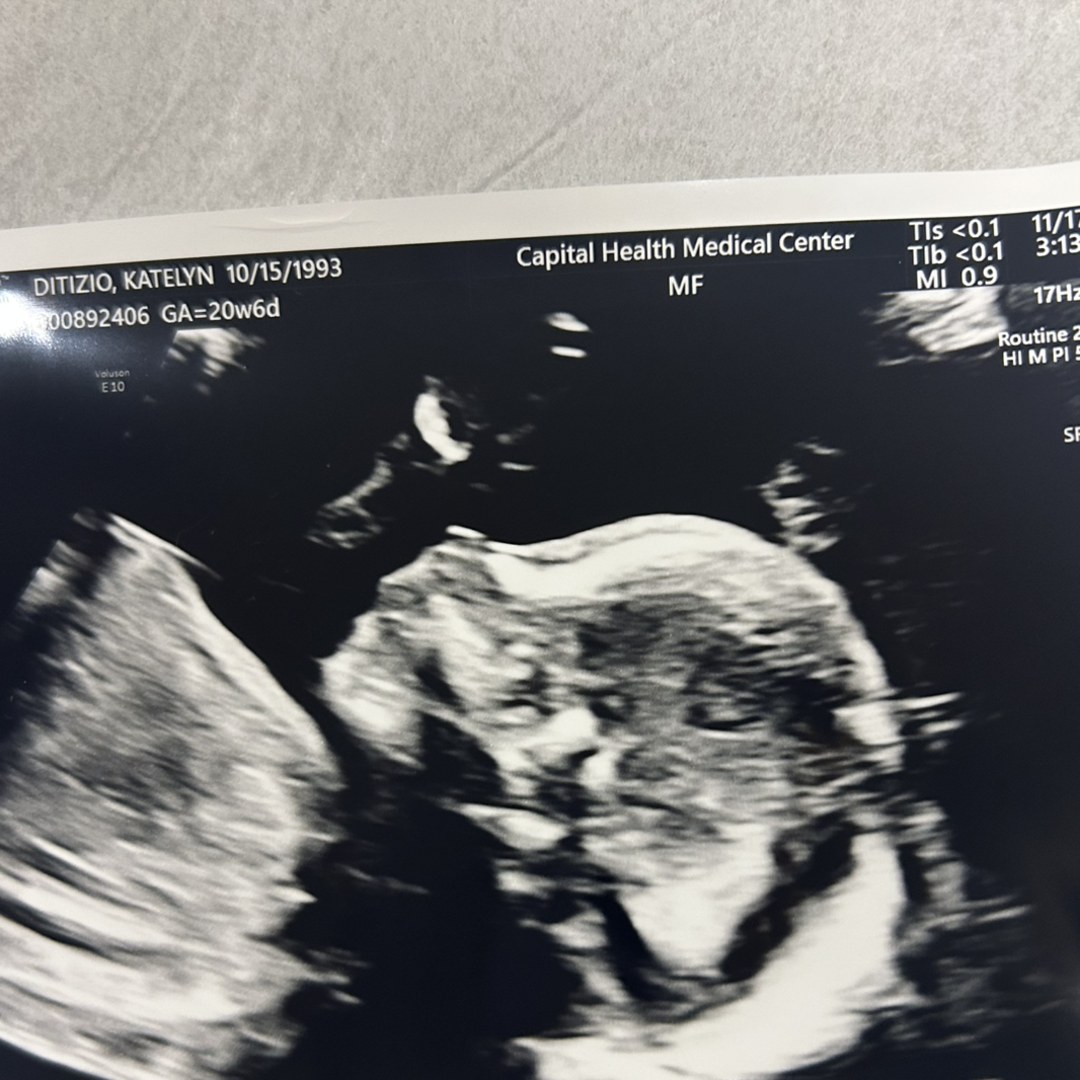 Photo shared by Katelyn for their Babylist baby registry.