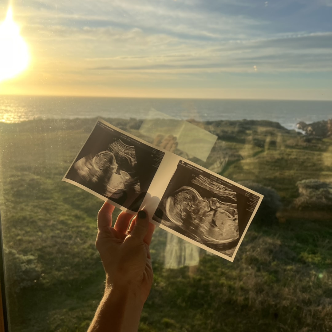 Photo shared by Maddie for their Babylist baby registry.