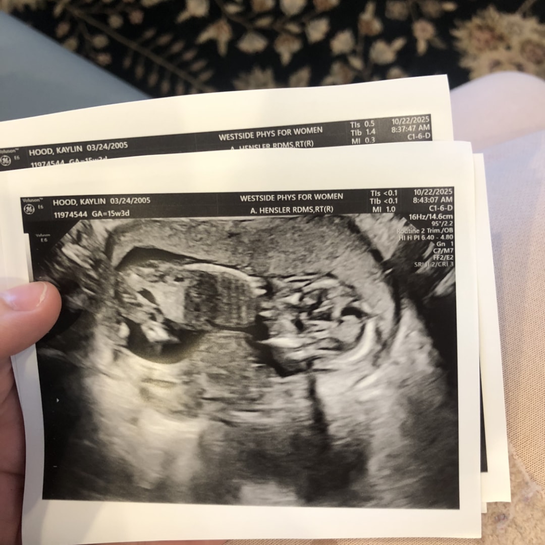 Photo shared by Kaylin for their Babylist baby registry.