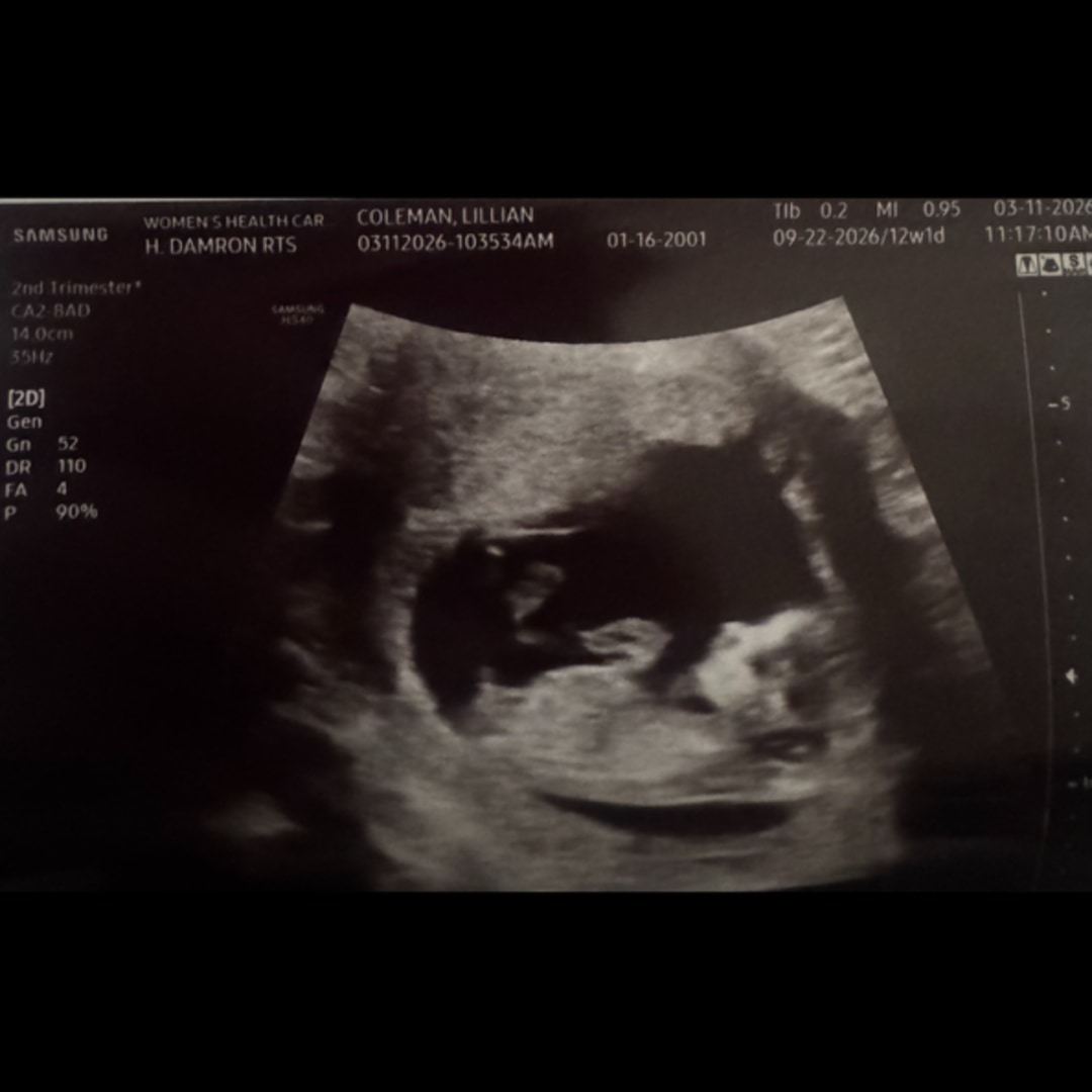 Photo shared by Lily for their Babylist baby registry.