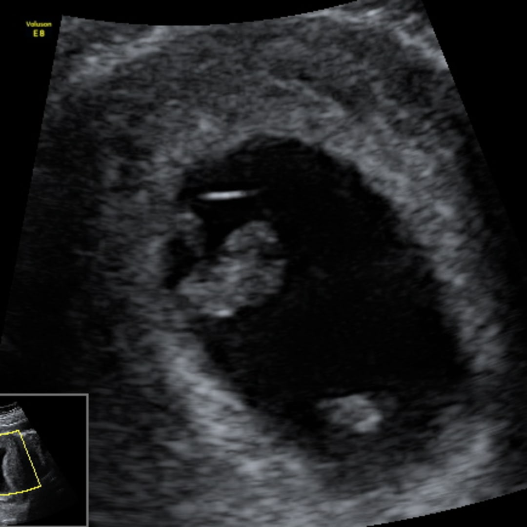 Photo shared by Kristen for their Babylist baby registry.