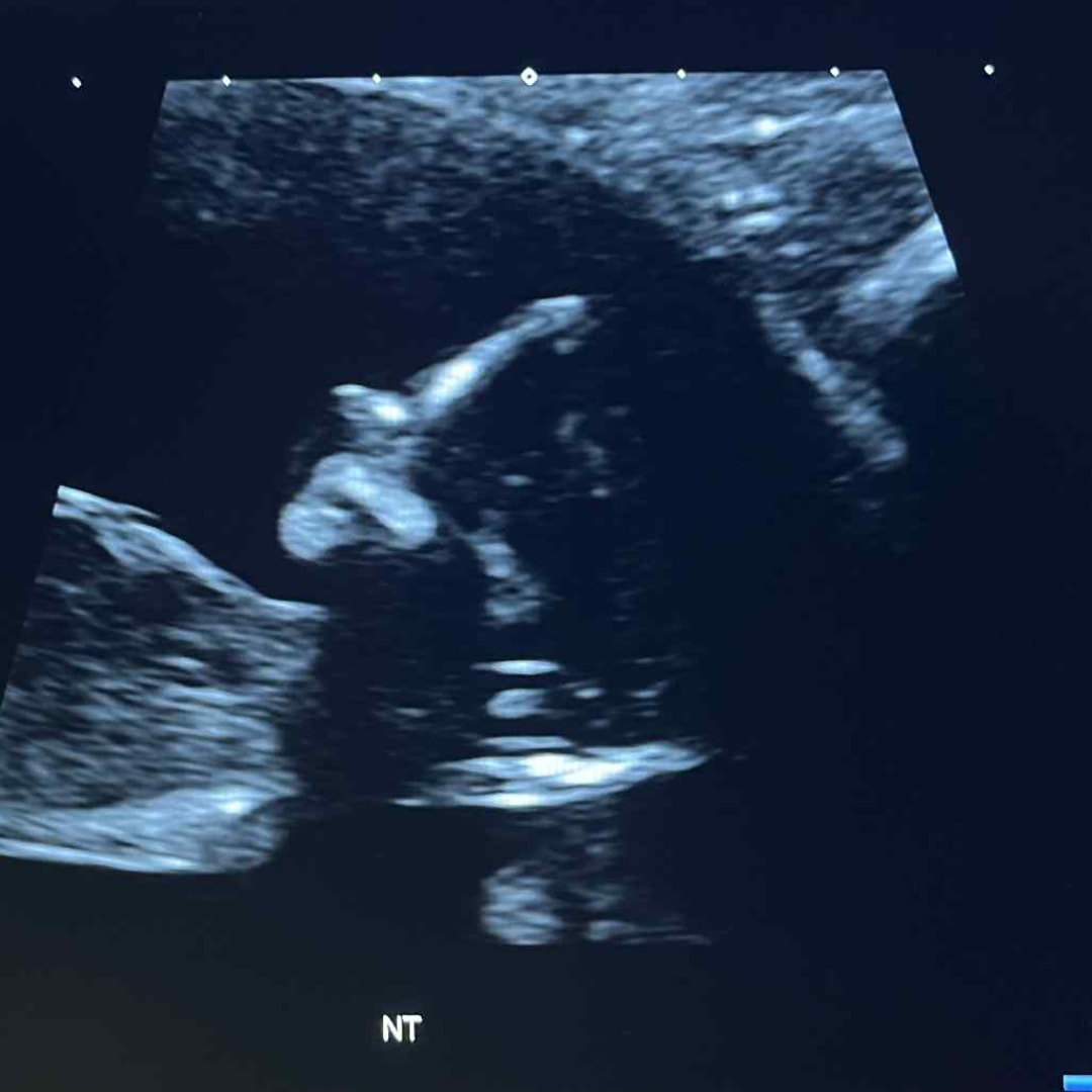 Photo shared by Jett for their Babylist baby registry.