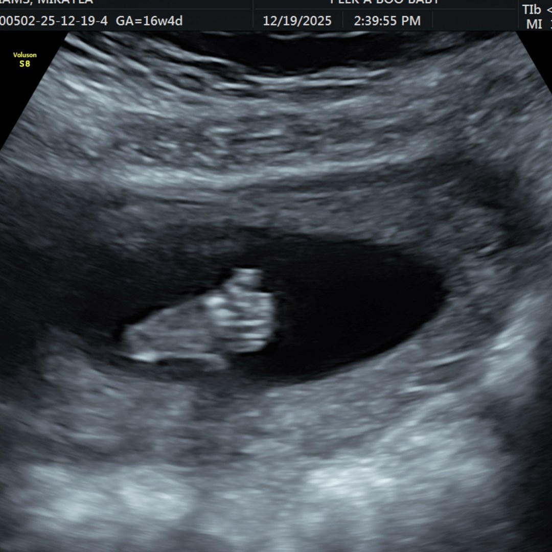 Photo shared by Mikayla for their Babylist baby registry.