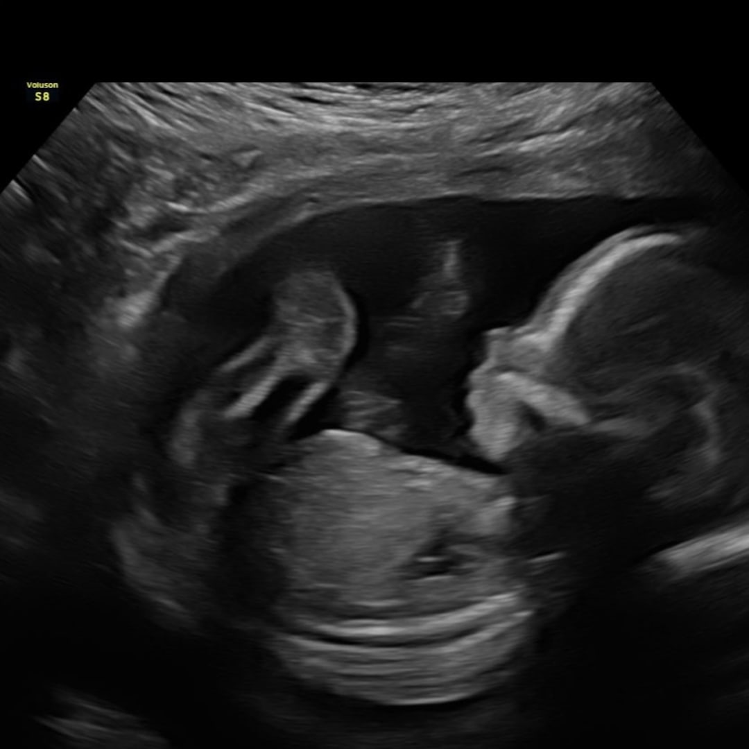Photo shared by Micah for their Babylist baby registry.