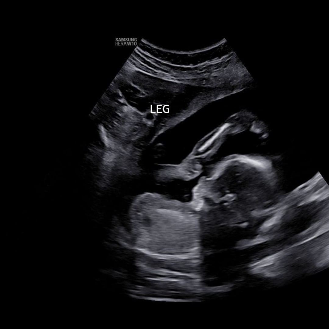 Photo shared by Lauren for their Babylist baby registry.