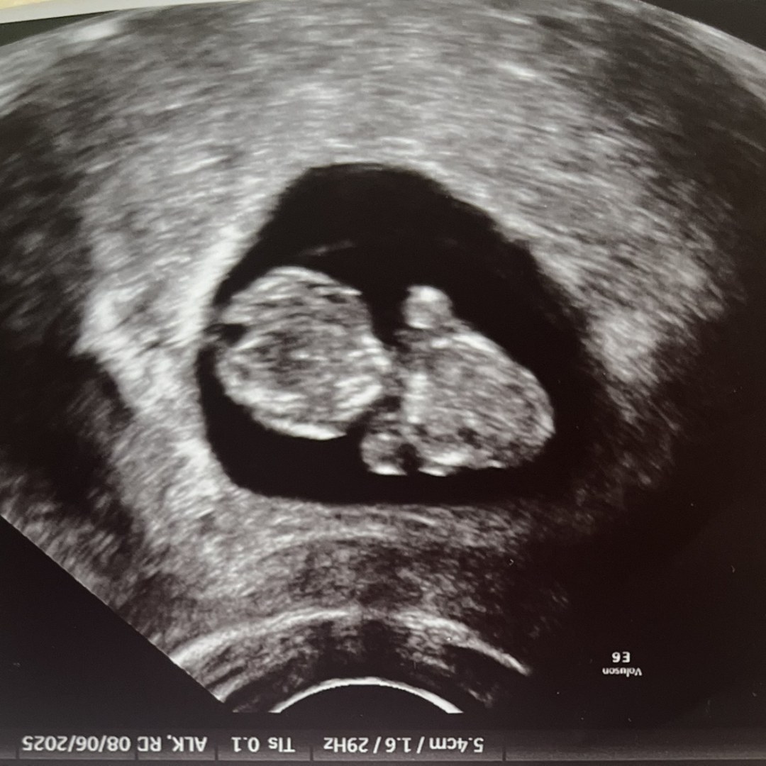 Photo shared by Haylie for their Babylist baby registry.