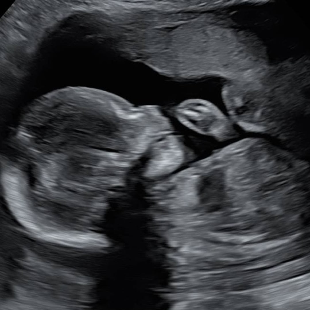 Photo shared by Kailey for their Babylist baby registry.