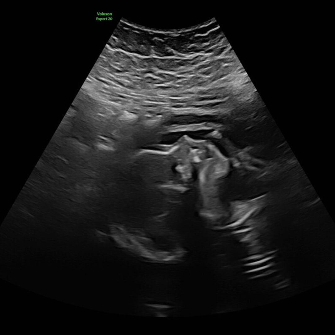 Photo shared by Ally for their Babylist baby registry.