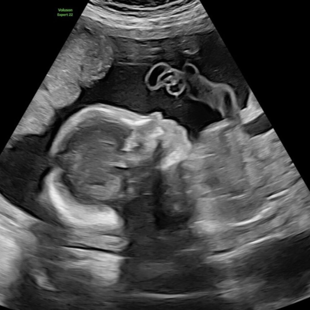 Photo shared by Lorelai for their Babylist baby registry.