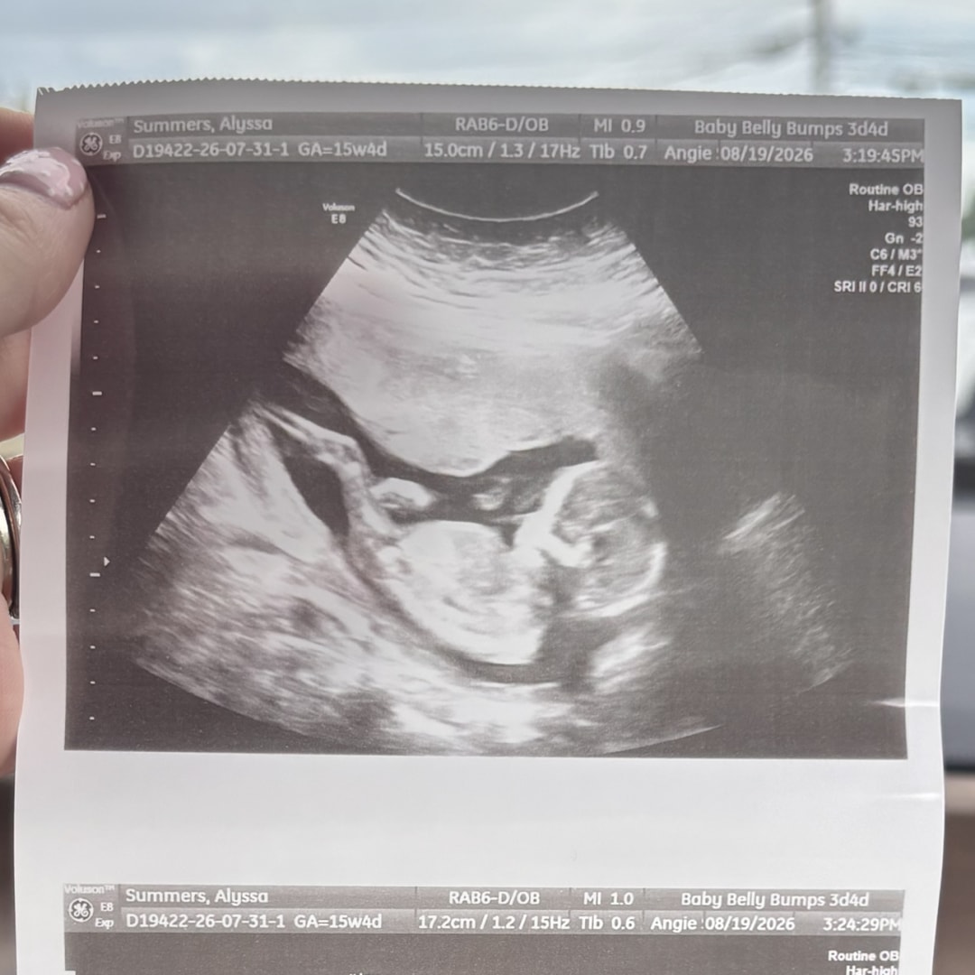Photo shared by Alyssa for their Babylist baby registry.