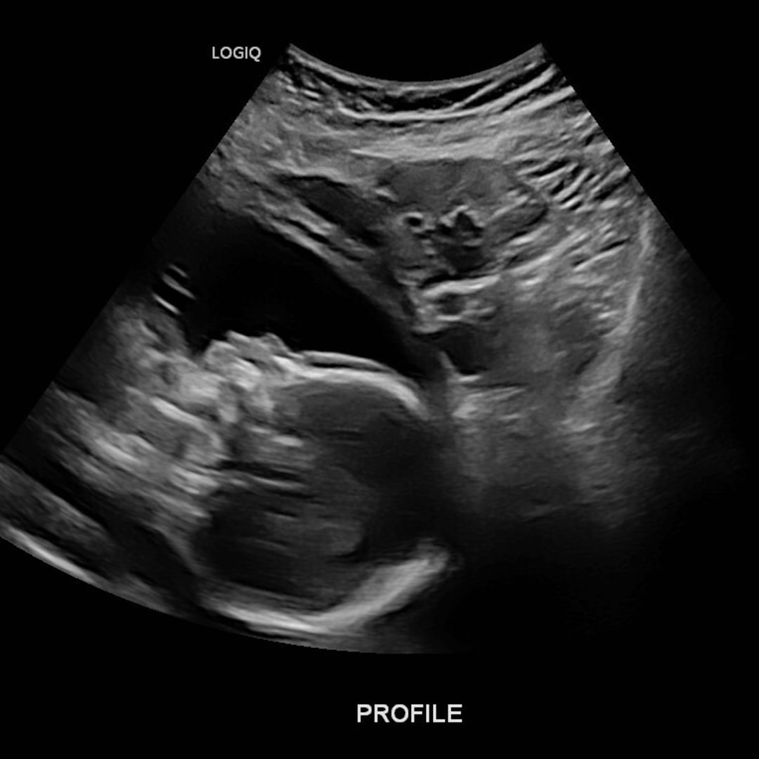 Photo shared by Amanda for their Babylist baby registry.