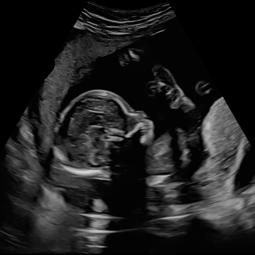 Photo shared by Fab & Mar for their Babylist baby registry.