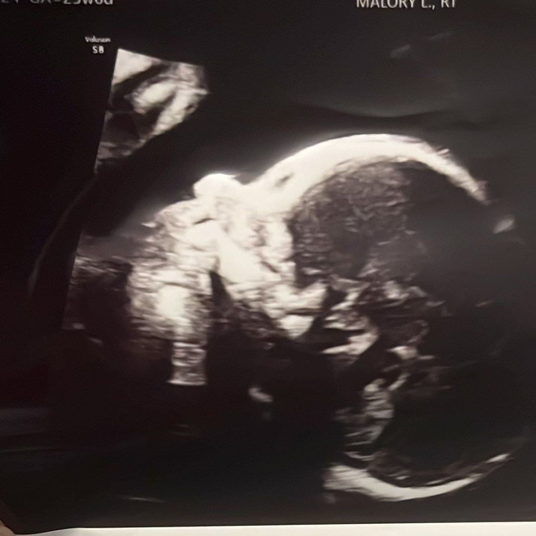 Photo shared by Katherine for their Babylist baby registry.