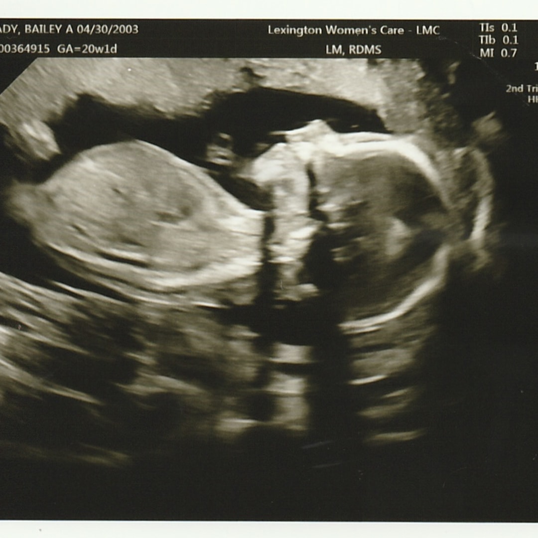 Photo shared by Bailey for their Babylist baby registry.