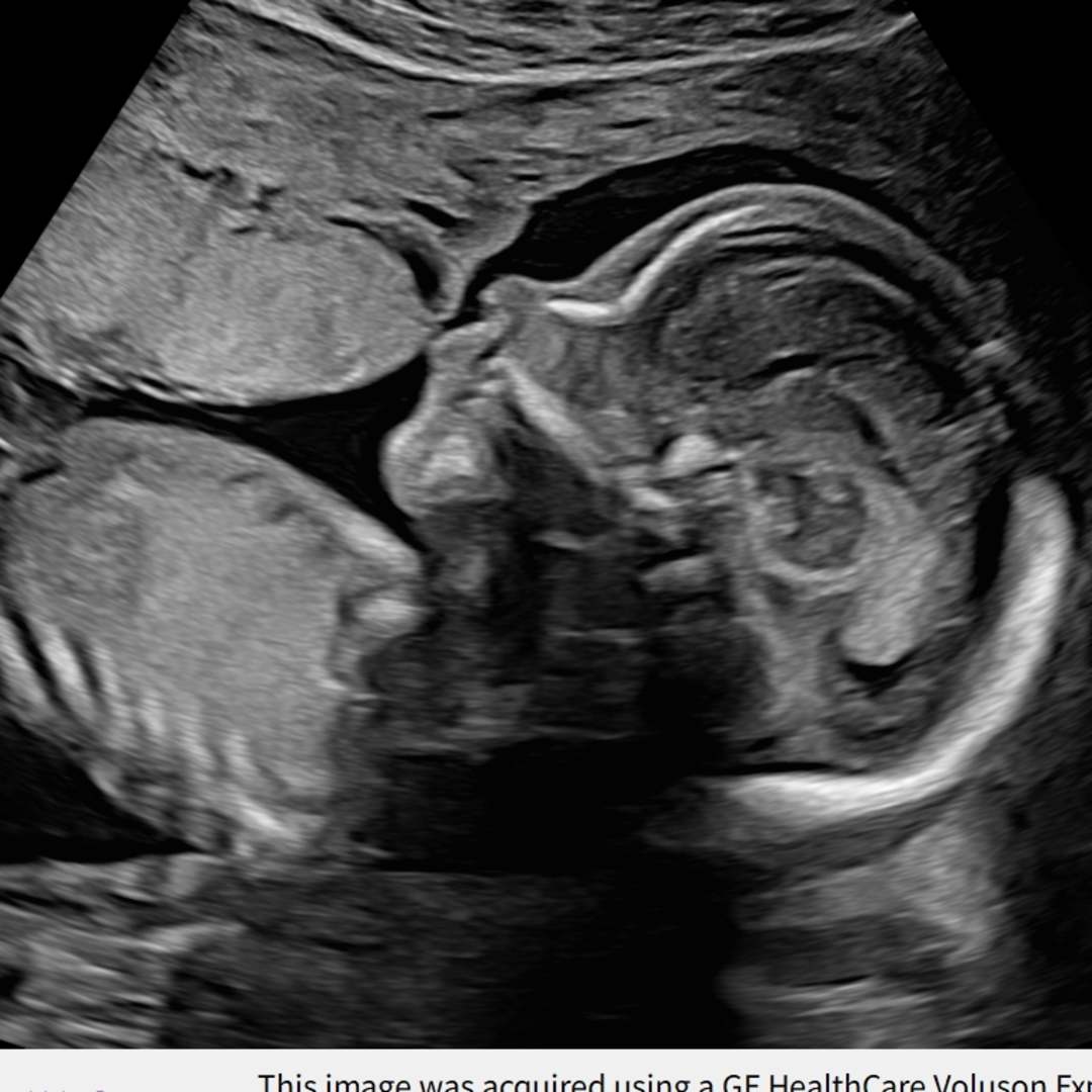 Photo shared by Danielle for their Babylist baby registry.