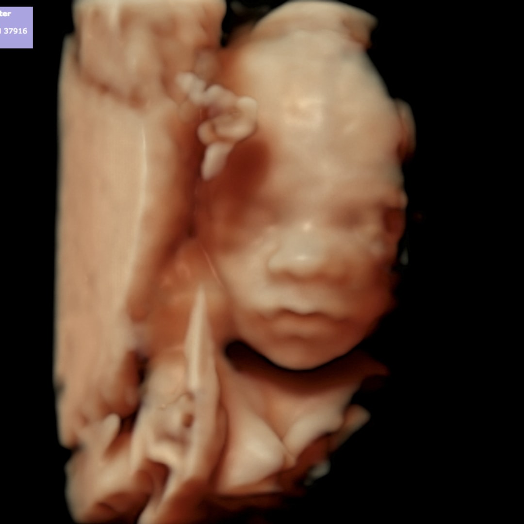 Photo shared by Rylie for their Babylist baby registry.