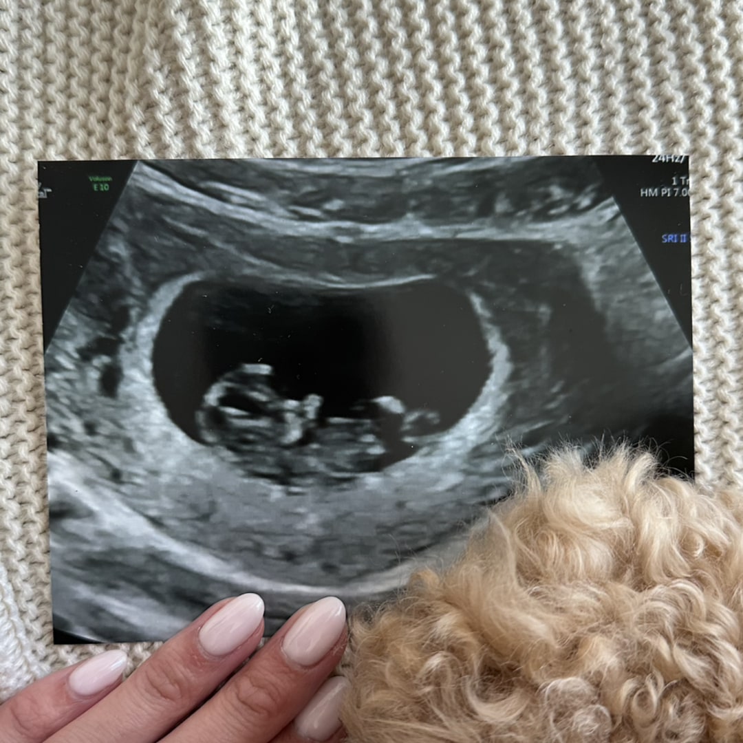Photo shared by Rochelle for their Babylist baby registry.