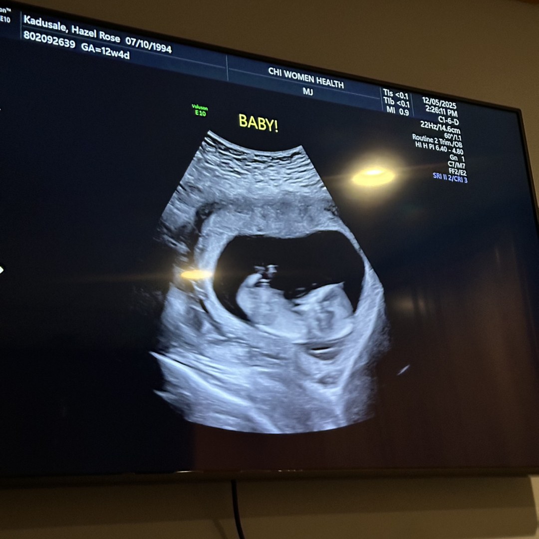 Photo shared by Hazel for their Babylist baby registry.