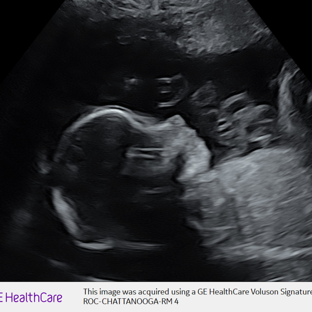 Photo shared by Taylor for their Babylist baby registry.