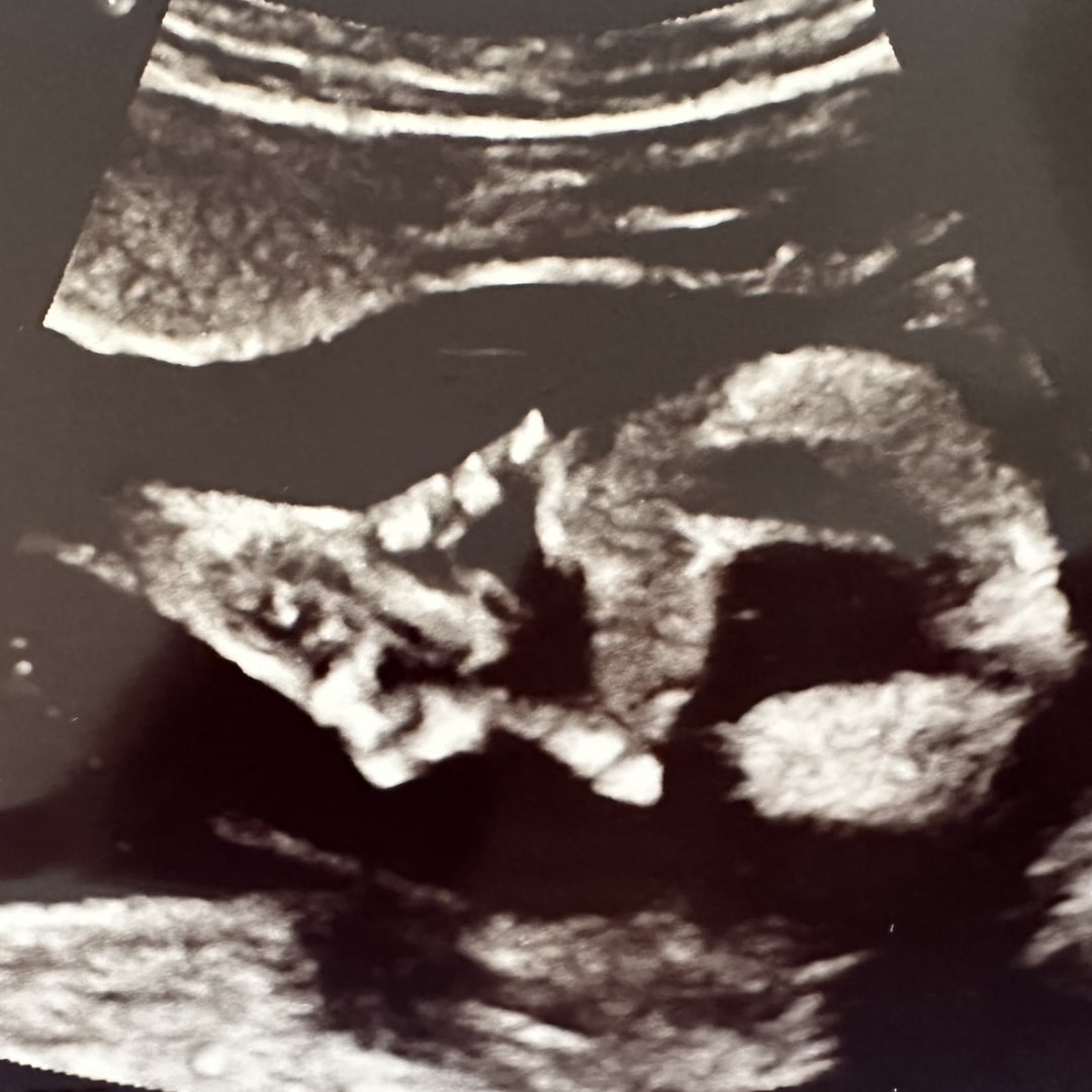 Photo shared by Emma for their Babylist baby registry.