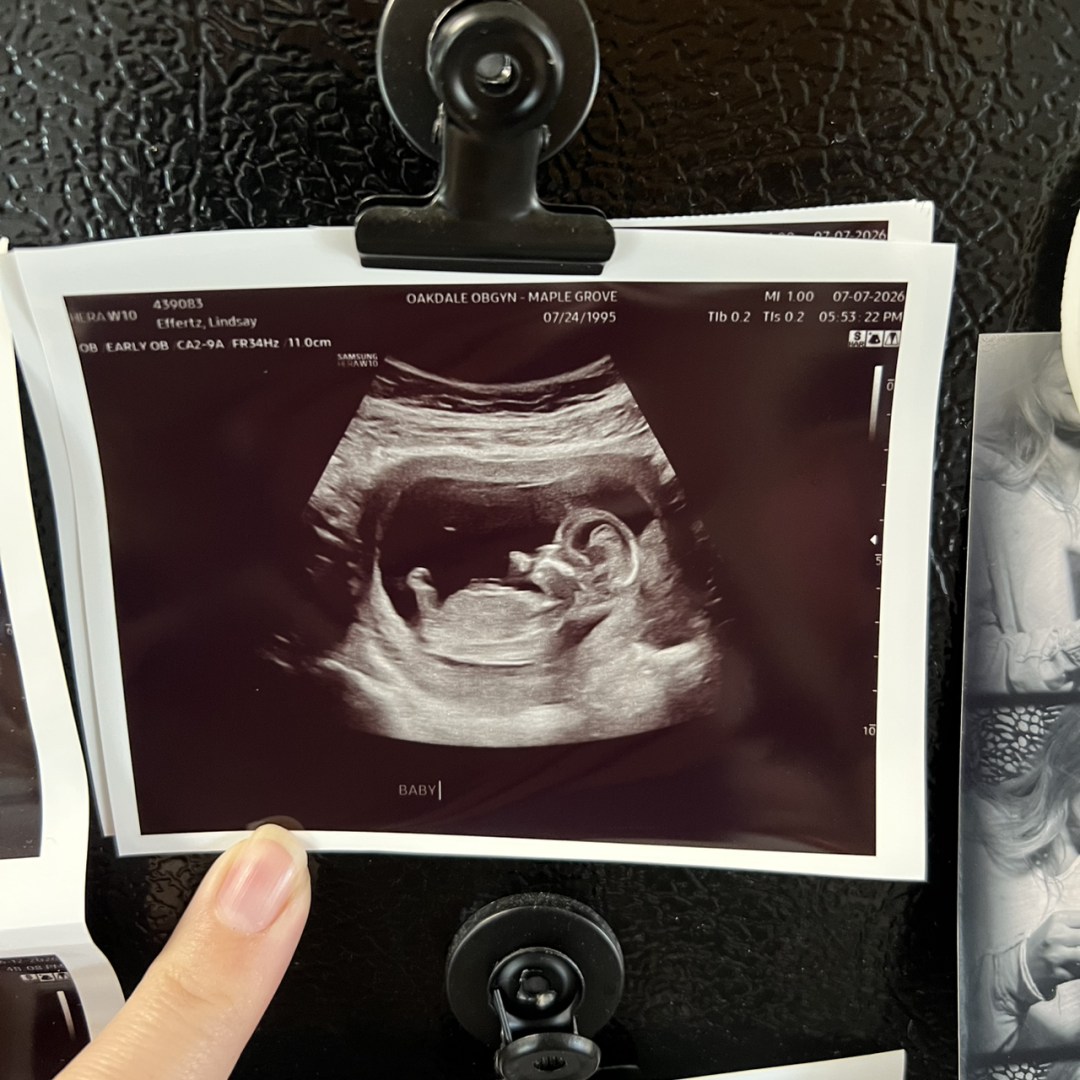 Photo shared by Lindsay for their Babylist baby registry.