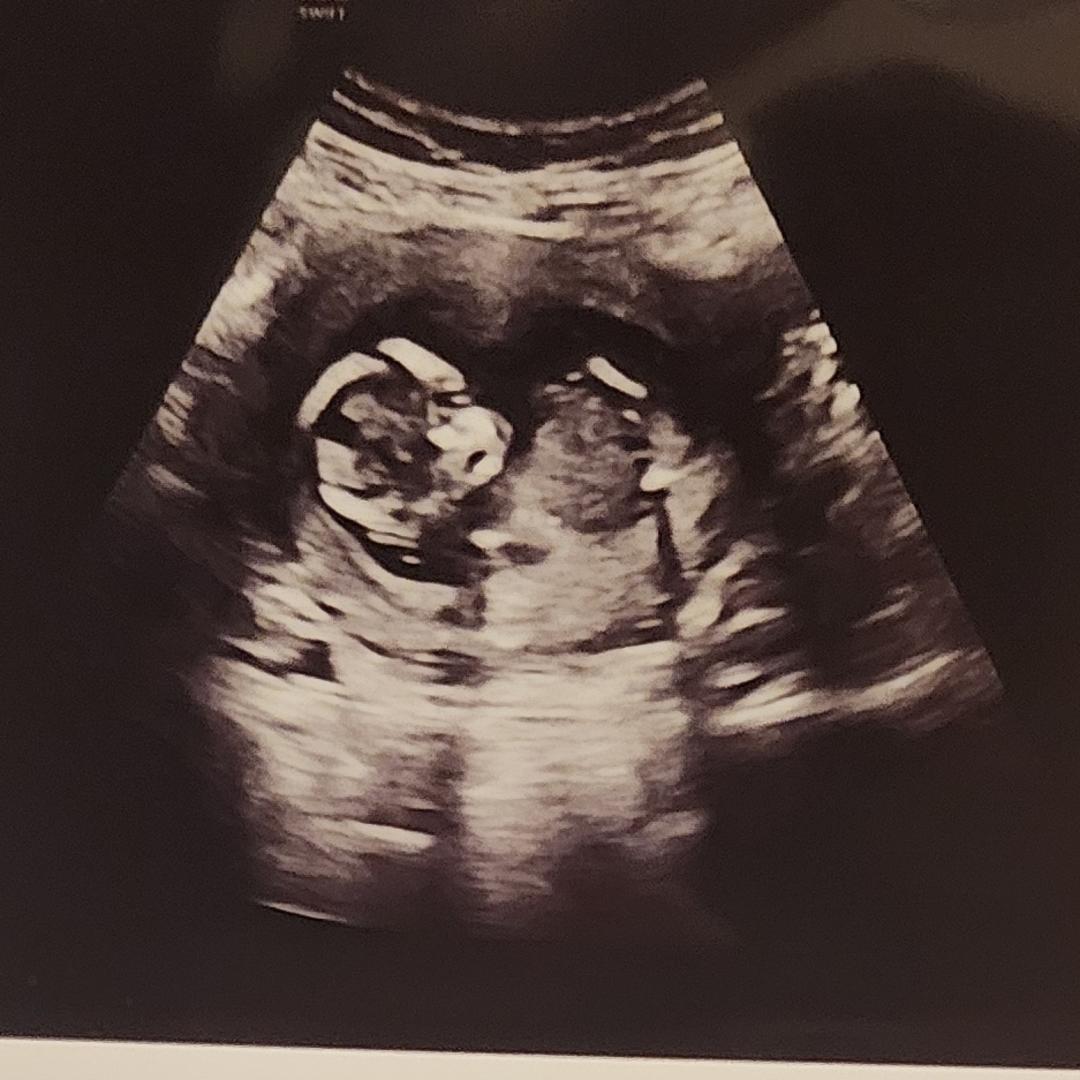 Photo shared by Breanna for their Babylist baby registry.