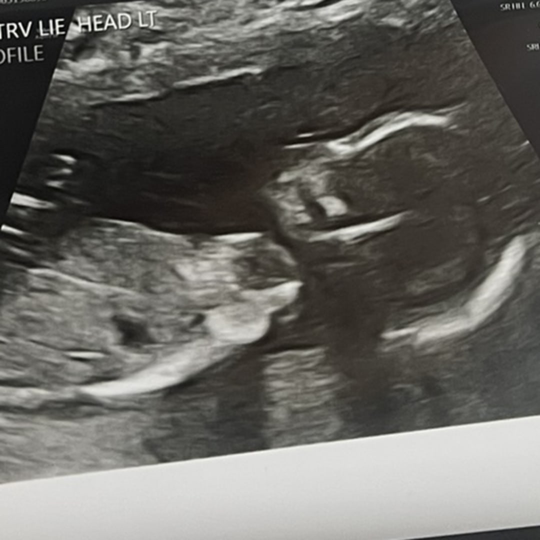 Photo shared by Mackenzie for their Babylist baby registry.