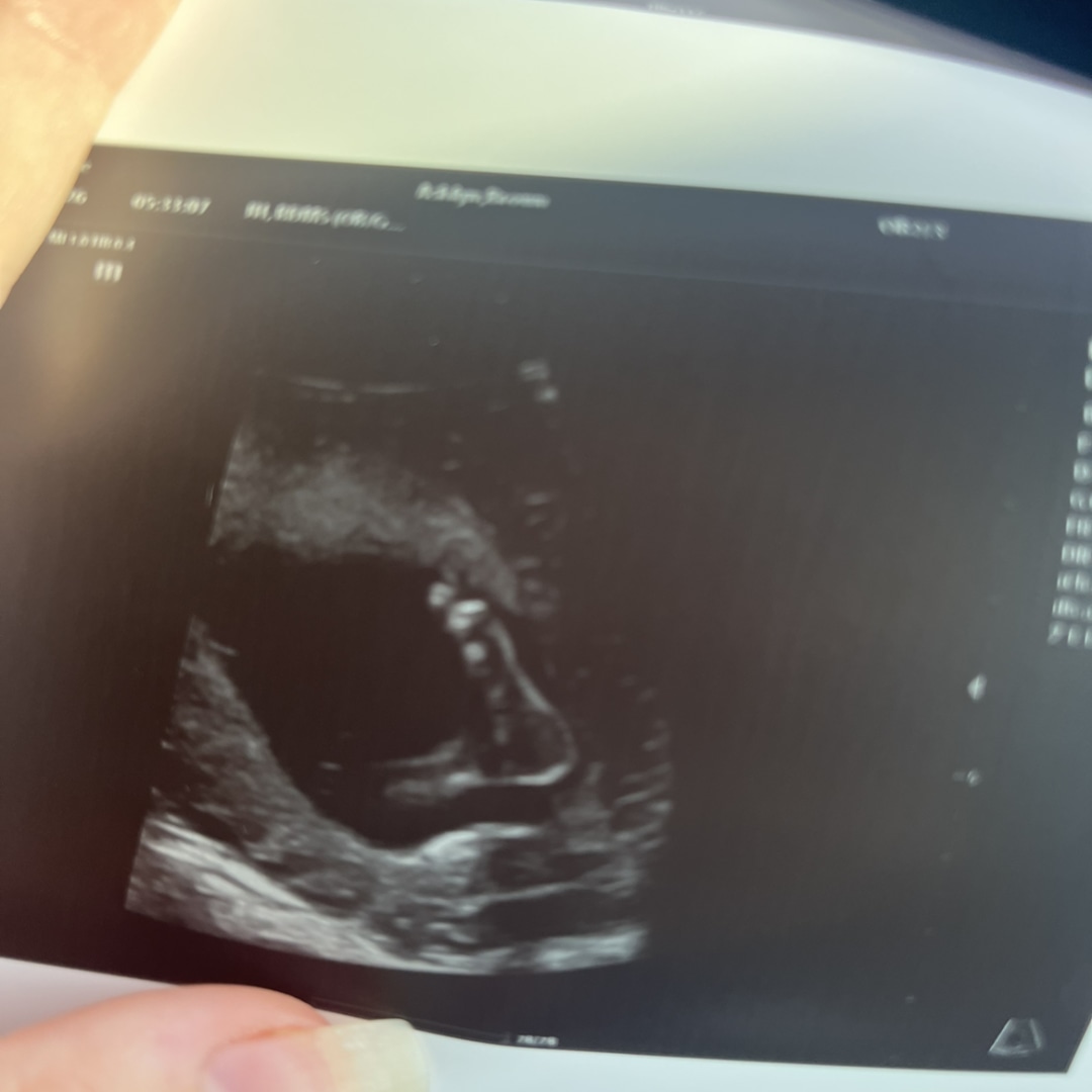 Photo shared by Ashlyn for their Babylist baby registry.