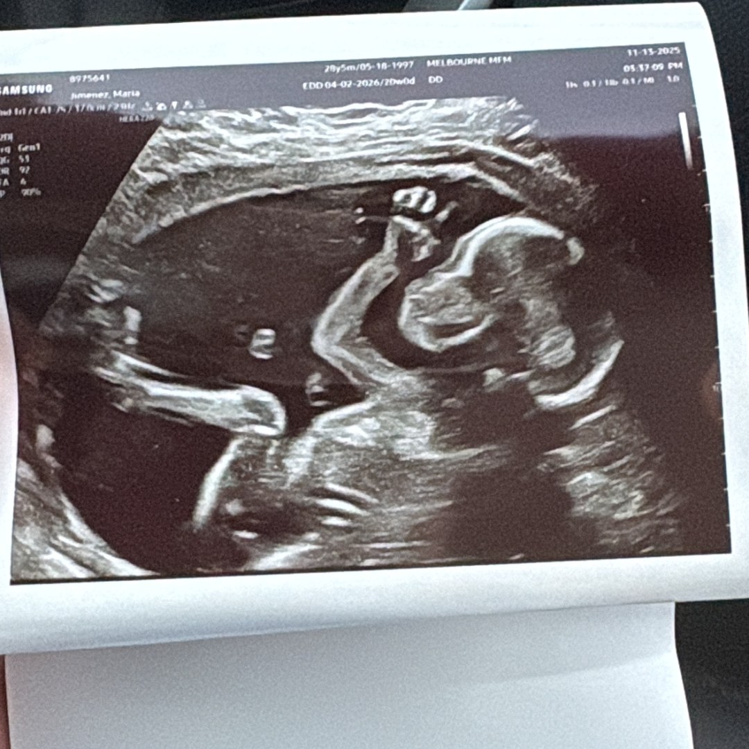 Photo shared by Devon for their Babylist baby registry.