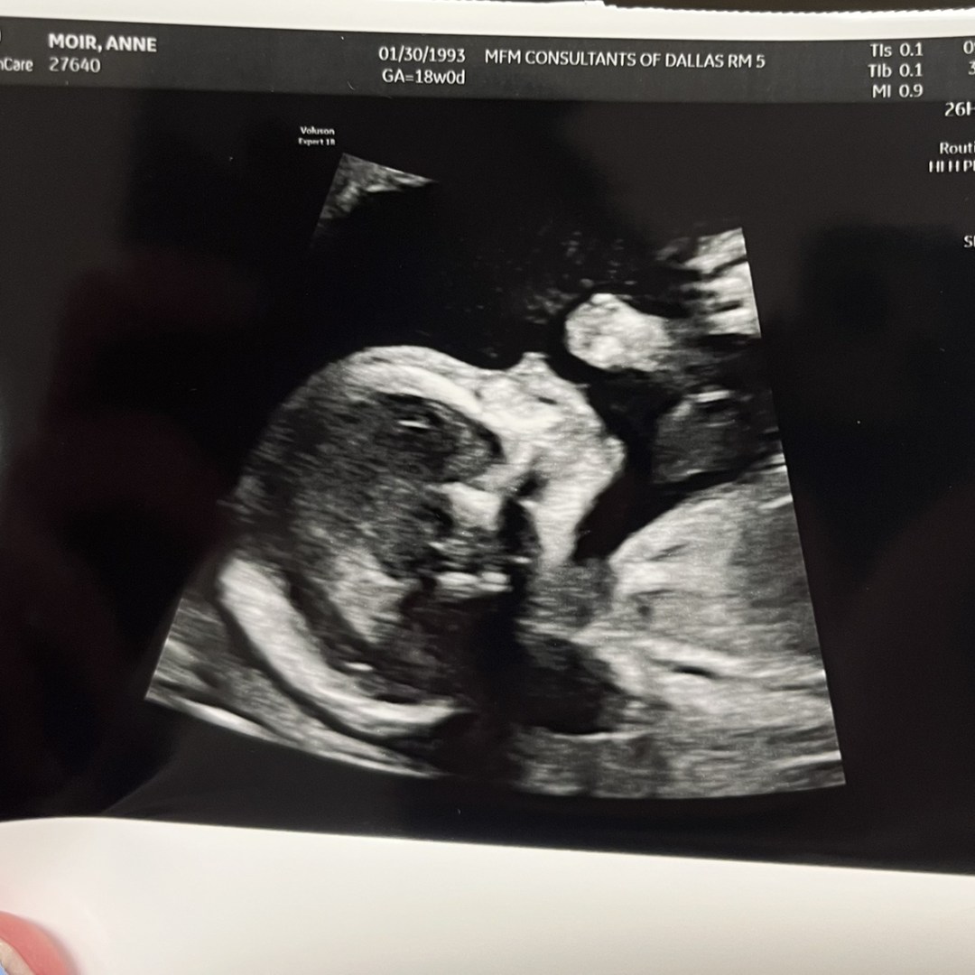 Photo shared by Annie for their Babylist baby registry.