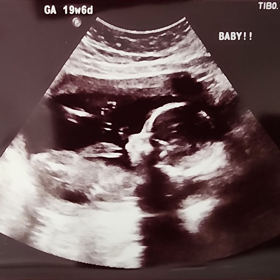 Photo shared by Elizabeth for their Babylist baby registry.