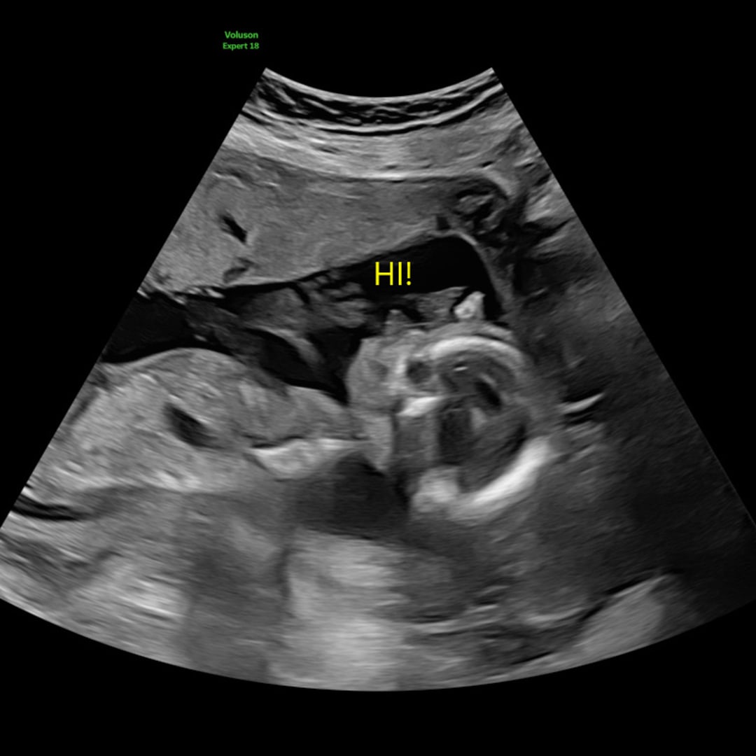 Photo shared by Cass for their Babylist baby registry.