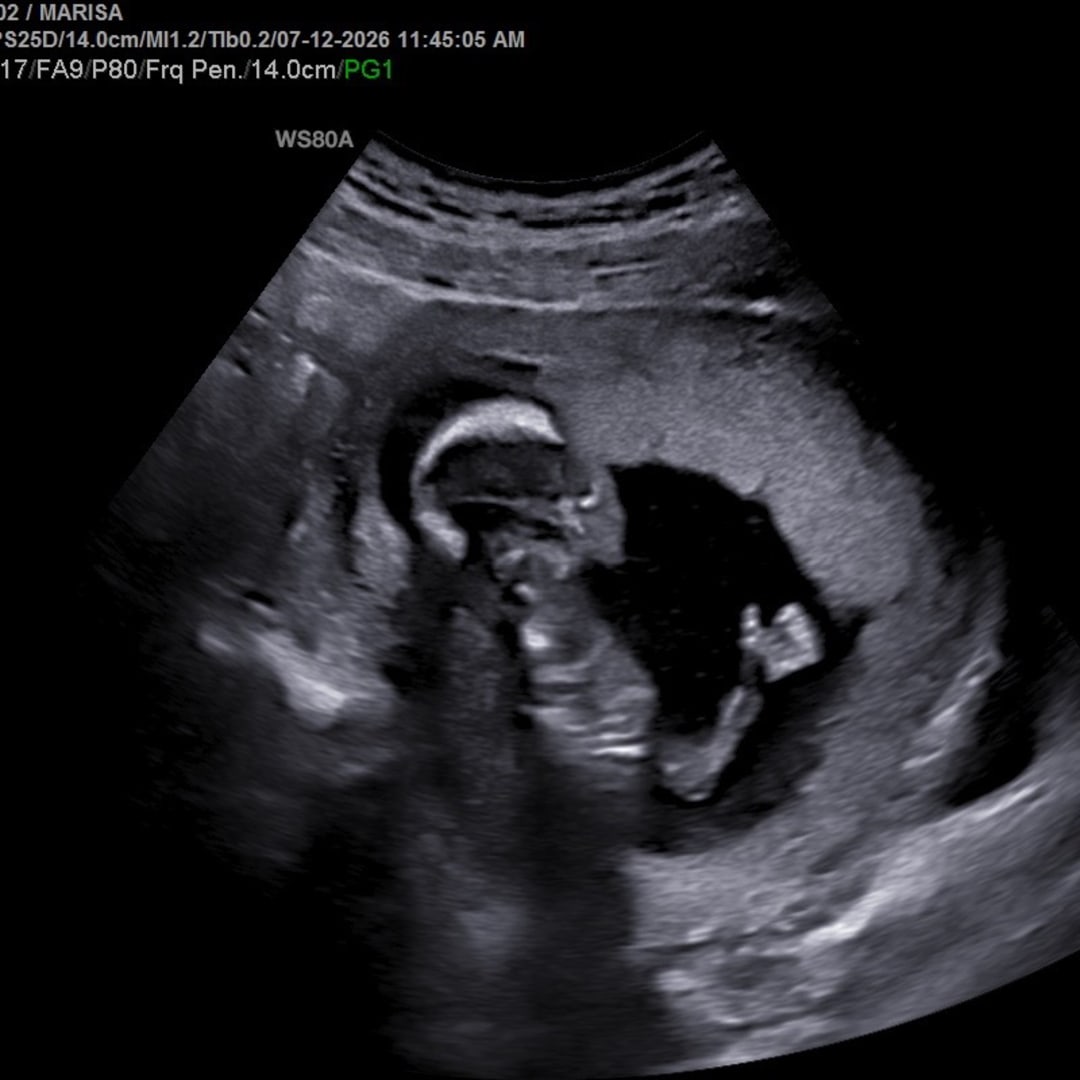 Photo shared by Marisa for their Babylist baby registry.