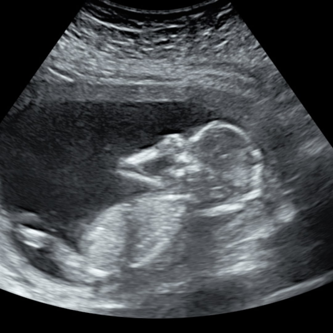 Photo shared by L for their Babylist baby registry.