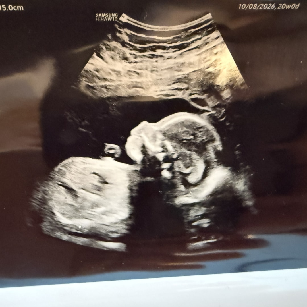 Photo shared by Kaitlin for their Babylist baby registry.