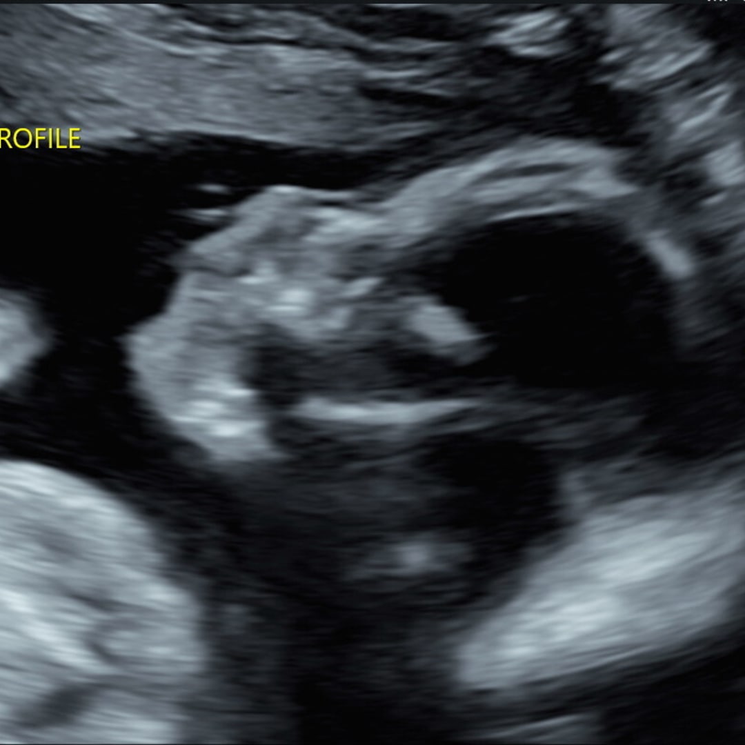 Photo shared by Emma for their Babylist baby registry.