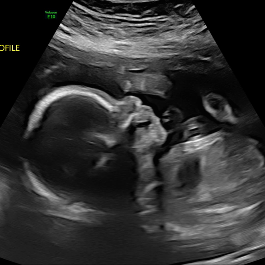 Photo shared by Lizet for their Babylist baby registry.