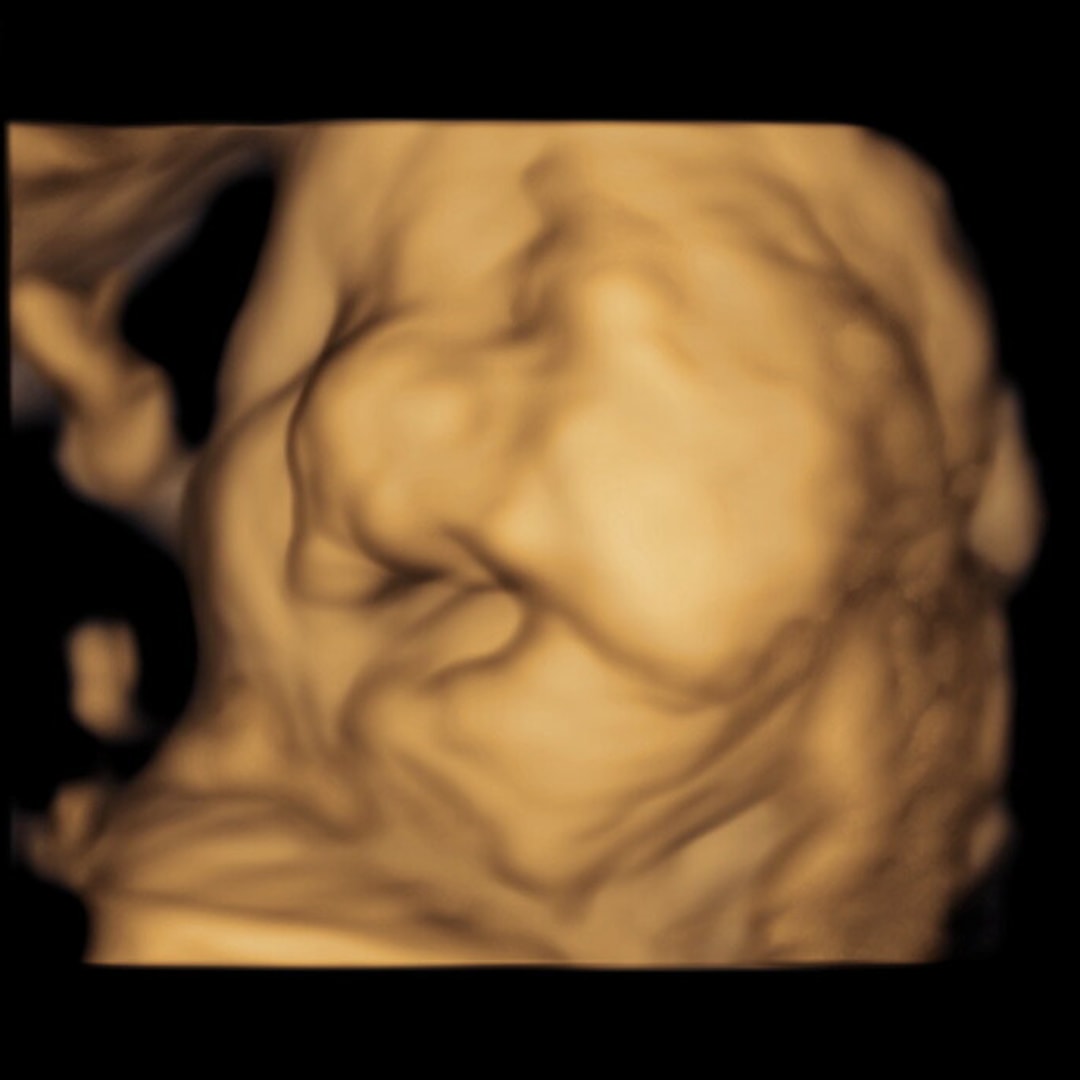 Photo shared by Lillie for their Babylist baby registry.