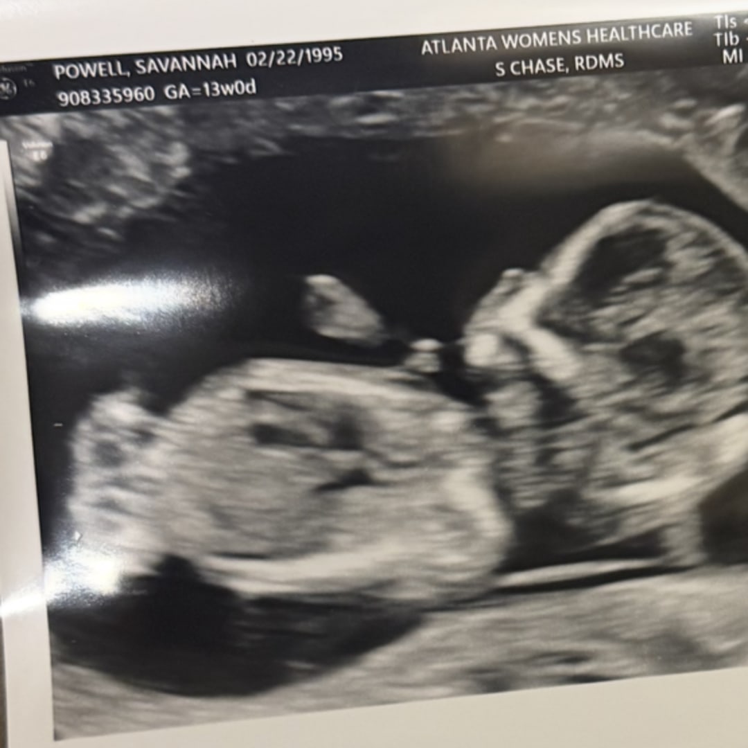 Photo shared by Savannah for their Babylist baby registry.