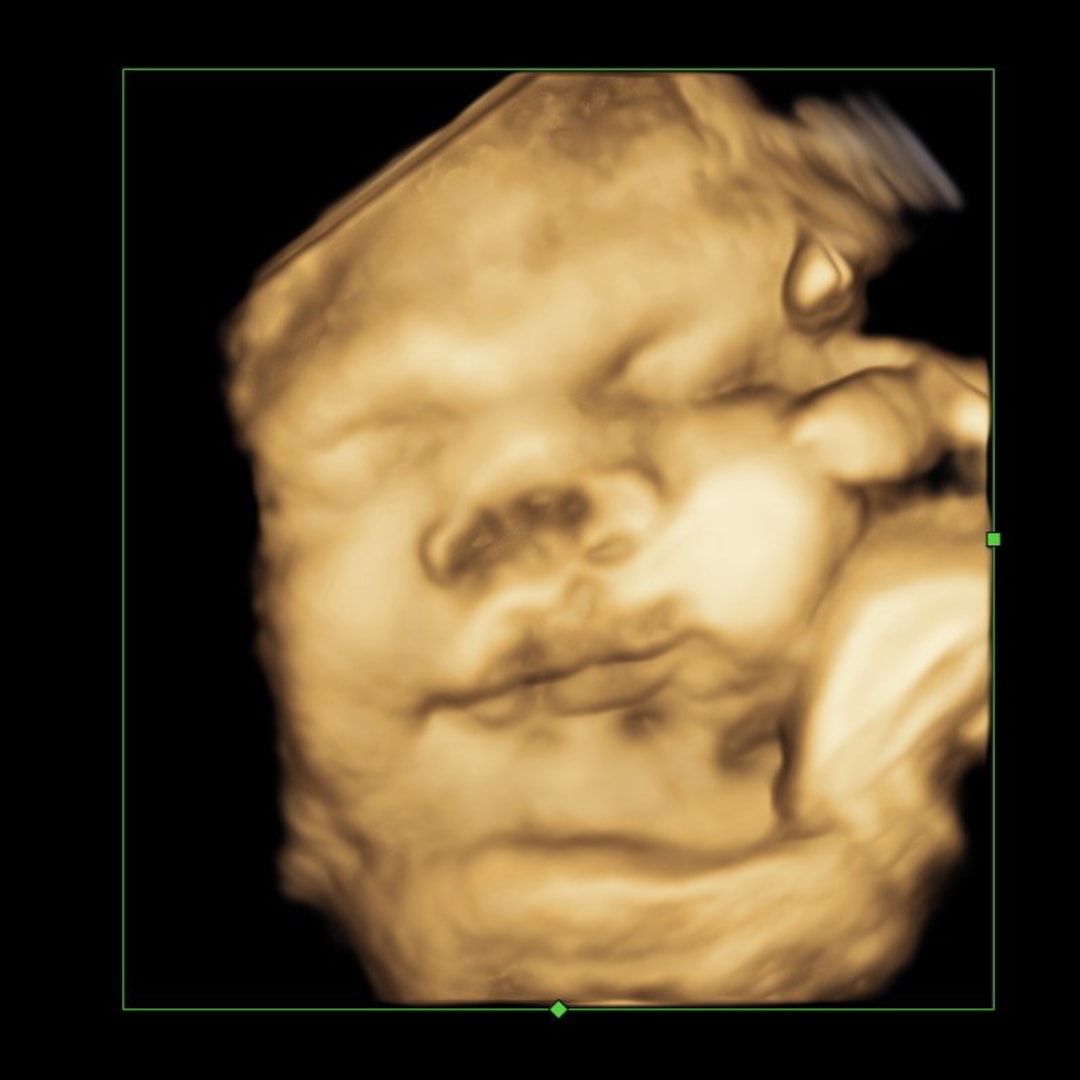 Photo shared by Nicole for their Babylist baby registry.