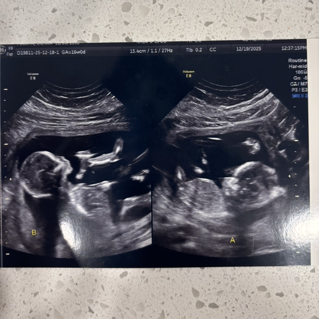 Photo shared by Lierra for their Babylist baby registry.