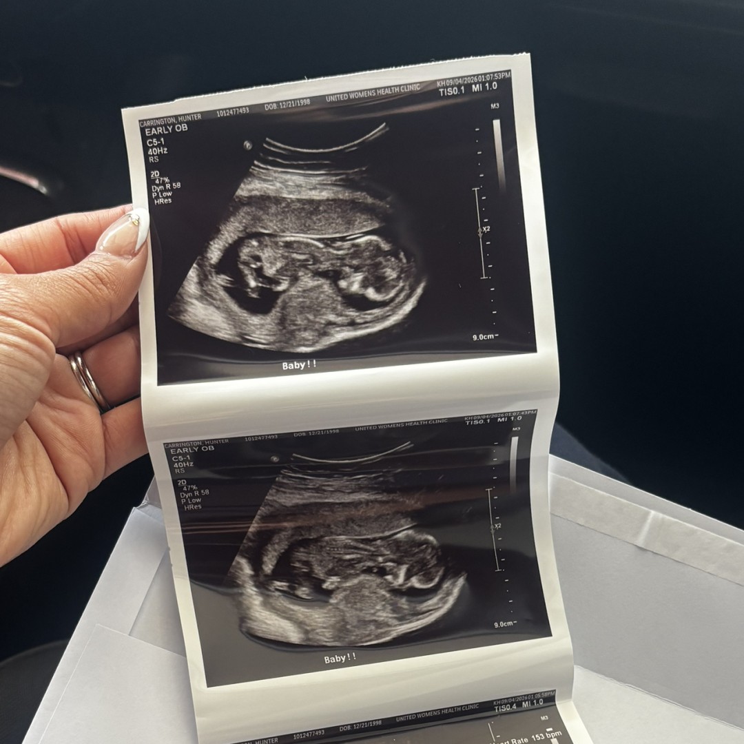 Photo shared by Hunter for their Babylist baby registry.