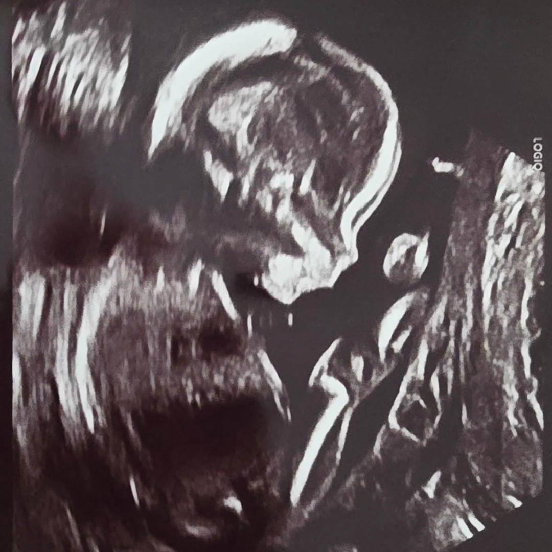 Photo shared by Jaida for their Babylist baby registry.