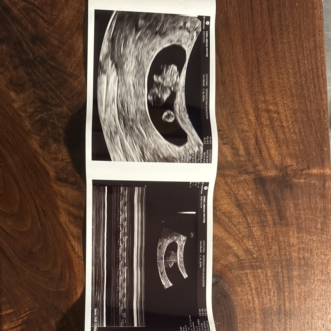 Photo shared by Abby for their Babylist baby registry.