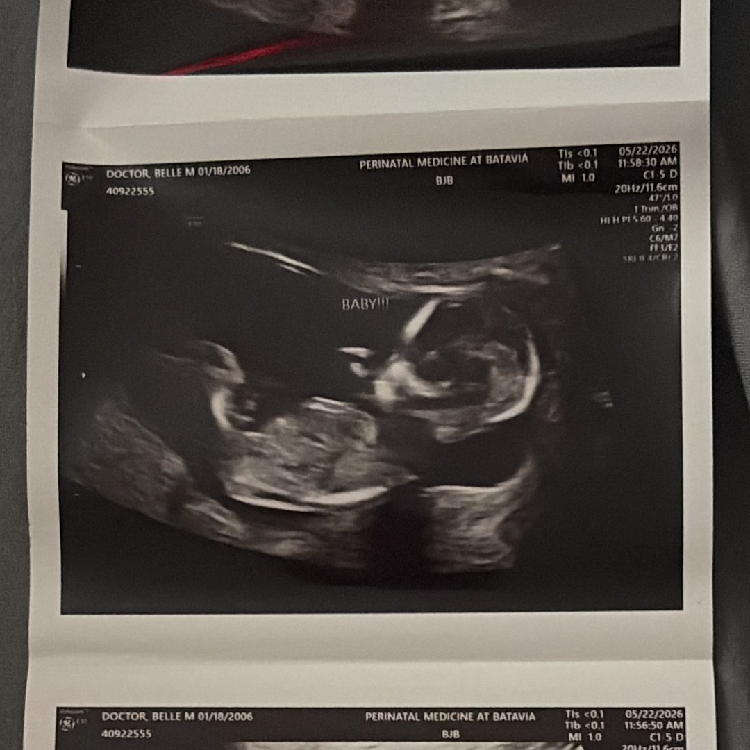 Photo shared by Belle for their Babylist baby registry.